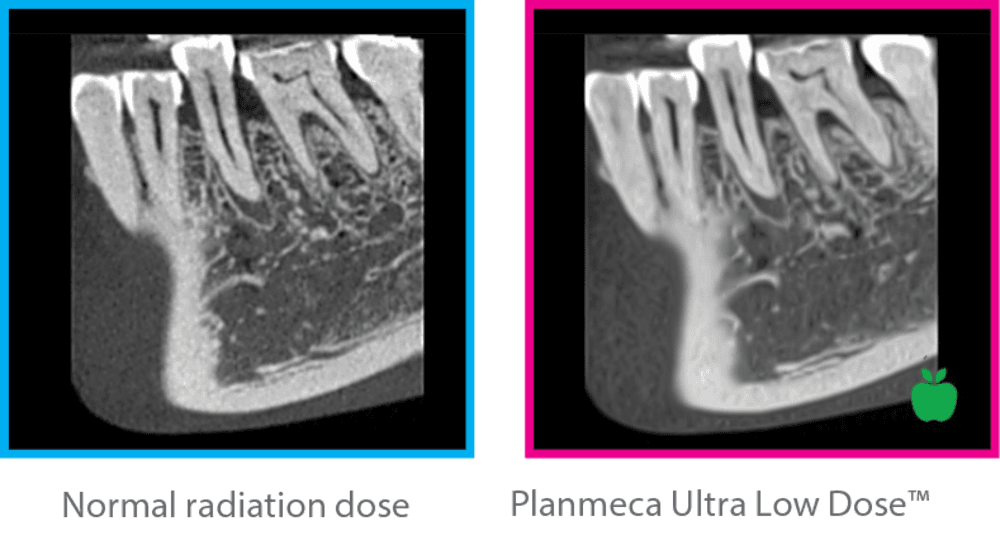 Planmeca Viso® CBCT