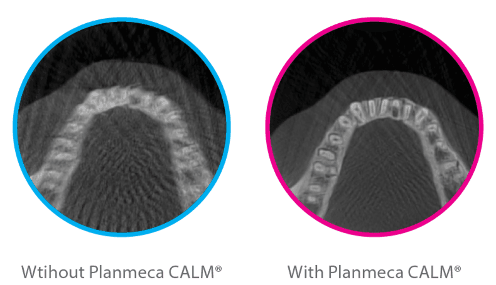 Planmeca Viso® CBCT