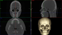 Planmeca Viso® CBCT