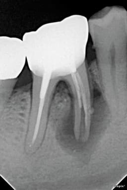 SOPIX2 Periapical