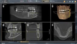 Axeos 8x8 HD X-ray