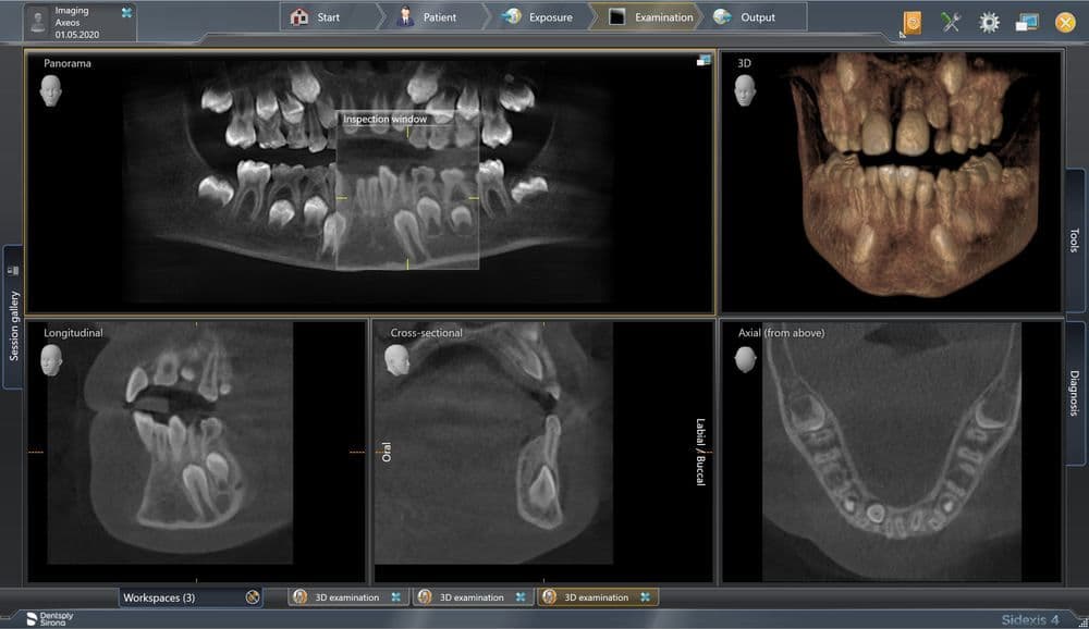 Axeos 8x8 Low-Dose X-ray