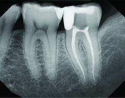 DEXIS Titanium Digital Radiography System