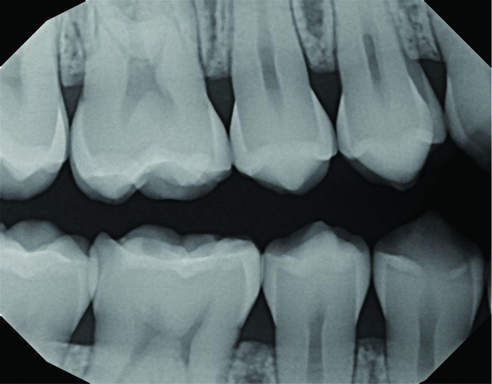 DEXIS Titanium Digital Radiography System