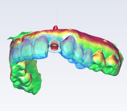 Planmeca PlanCAD Romexis Implant Software