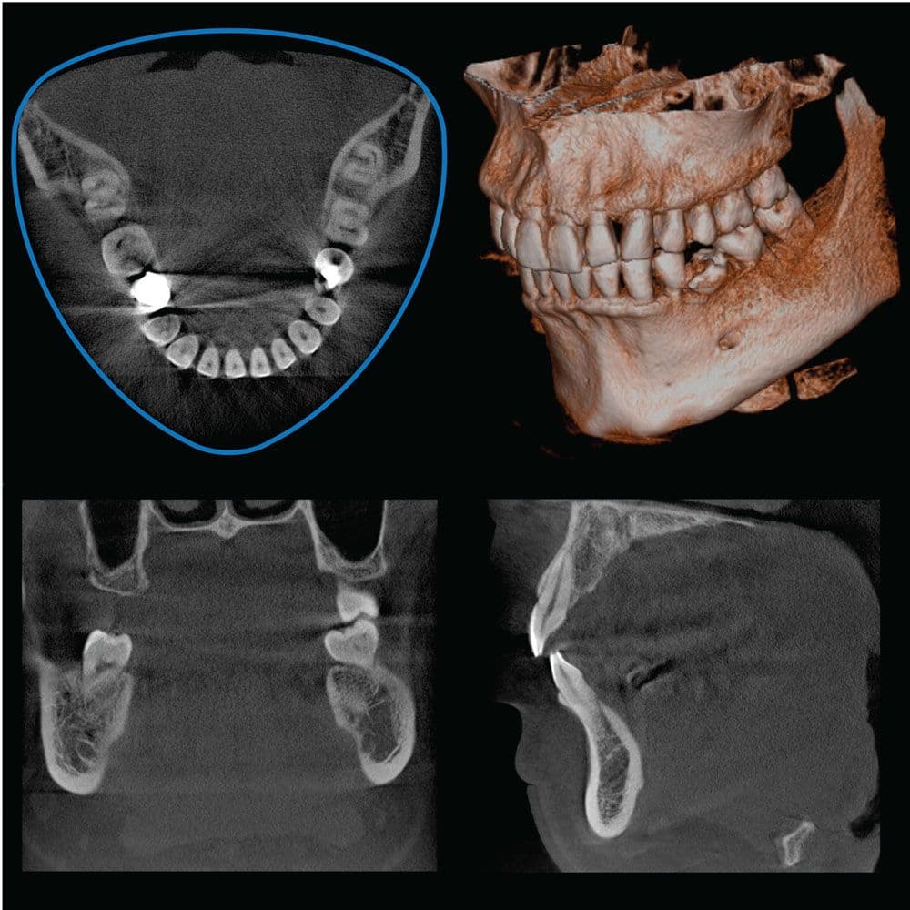 R100 Clinical