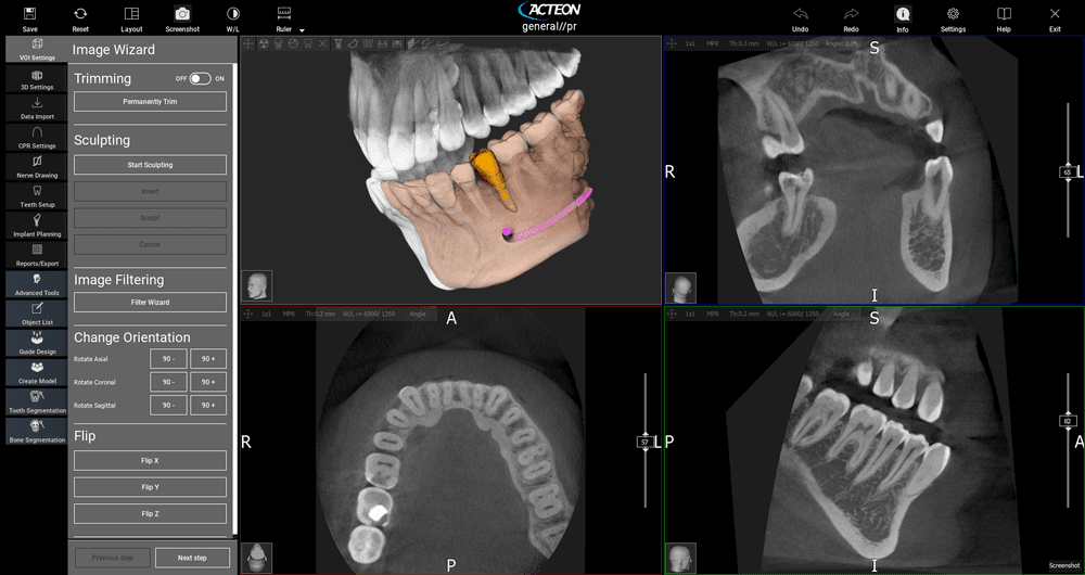 X-Mind Prime with Ceph