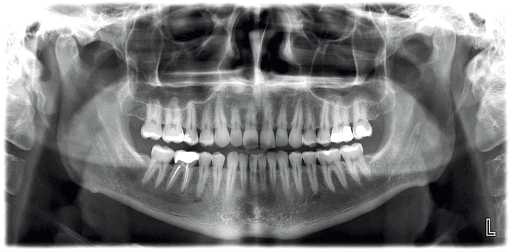 Planmeca ProMax® 3D LEC CBCT Unit