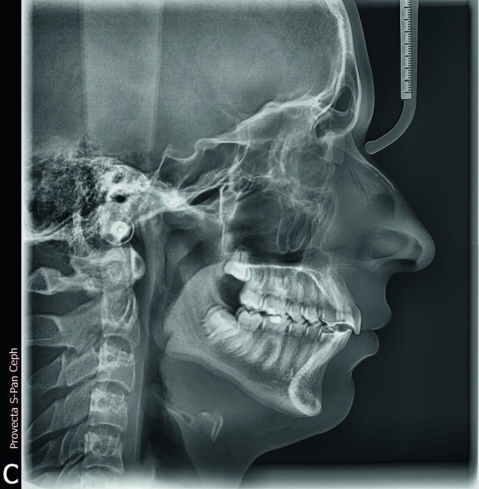 PA HEAD X-Ray
