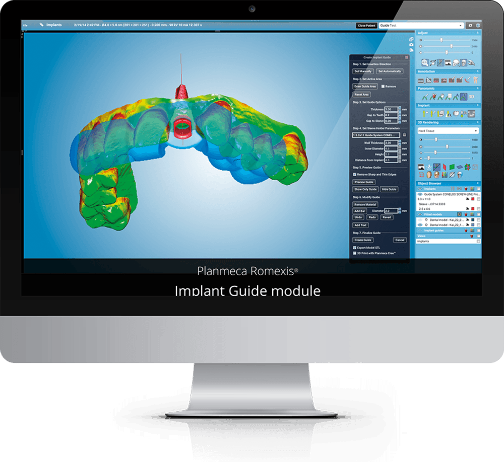 Planmeca Implant Workflow design