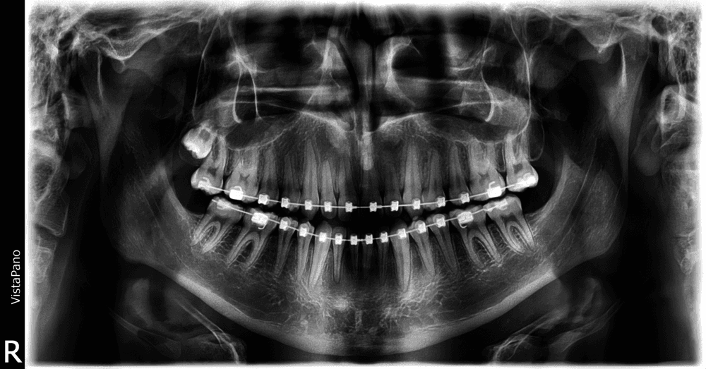 High Quality X-Ray Technology