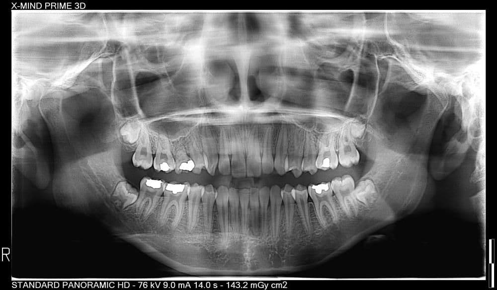 X-Mind Prime with Ceph