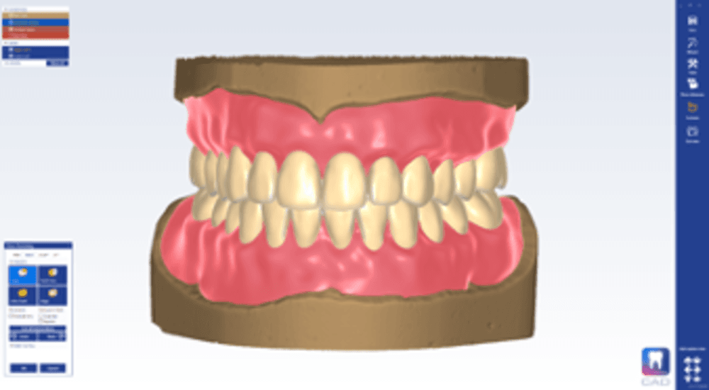 Planmeca PlanCAD Premium Software