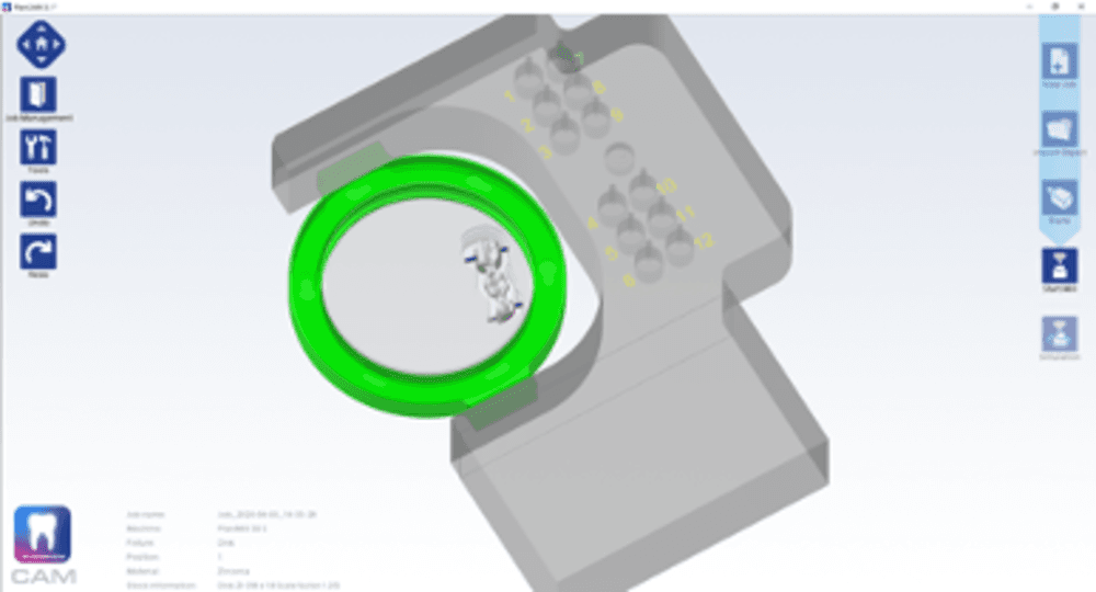 Planmeca PlanCAD Premium Software