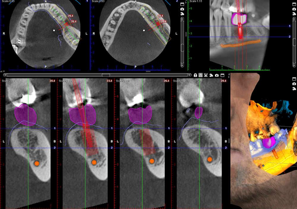 Planmeca ProMax® 3D LEC CBCT Unit