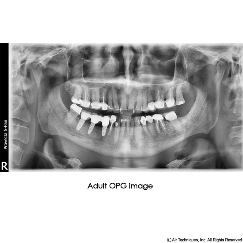 Adult OPG Image