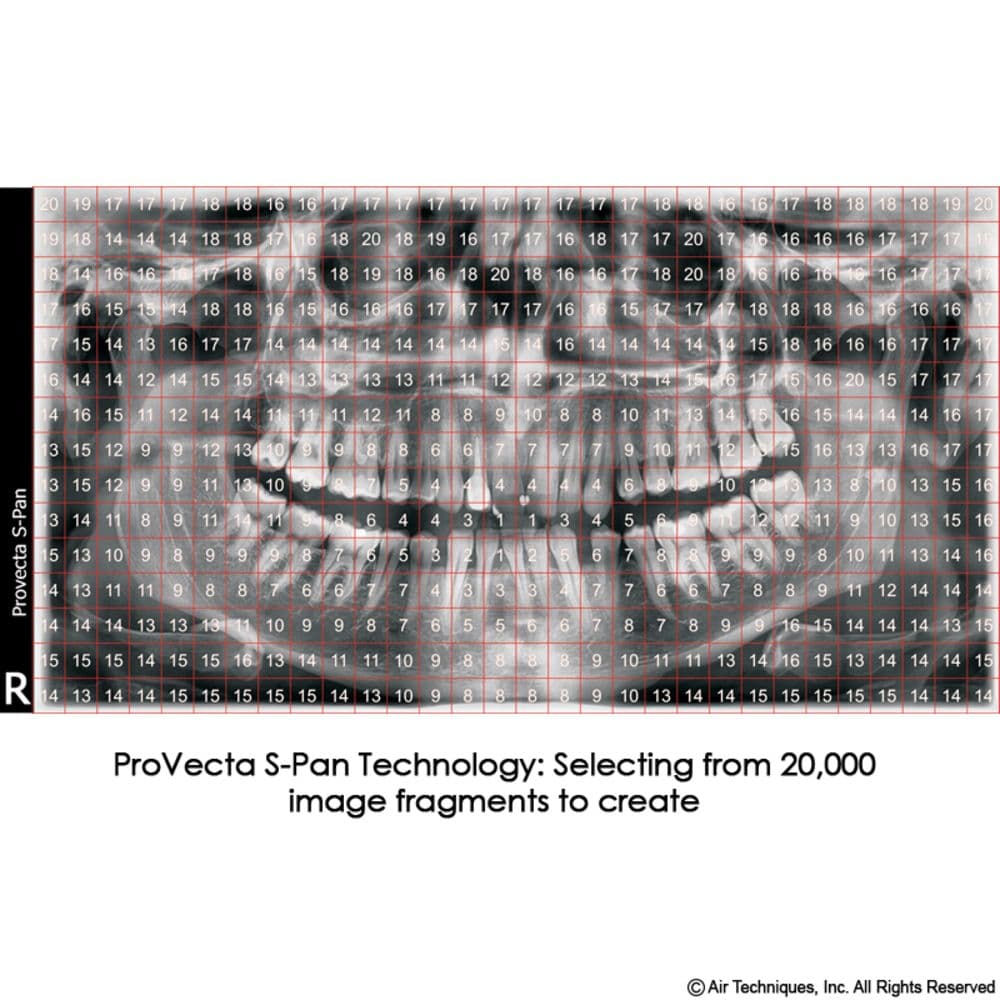 Provecta S-Pan Technology with 20,000 Image Fragments