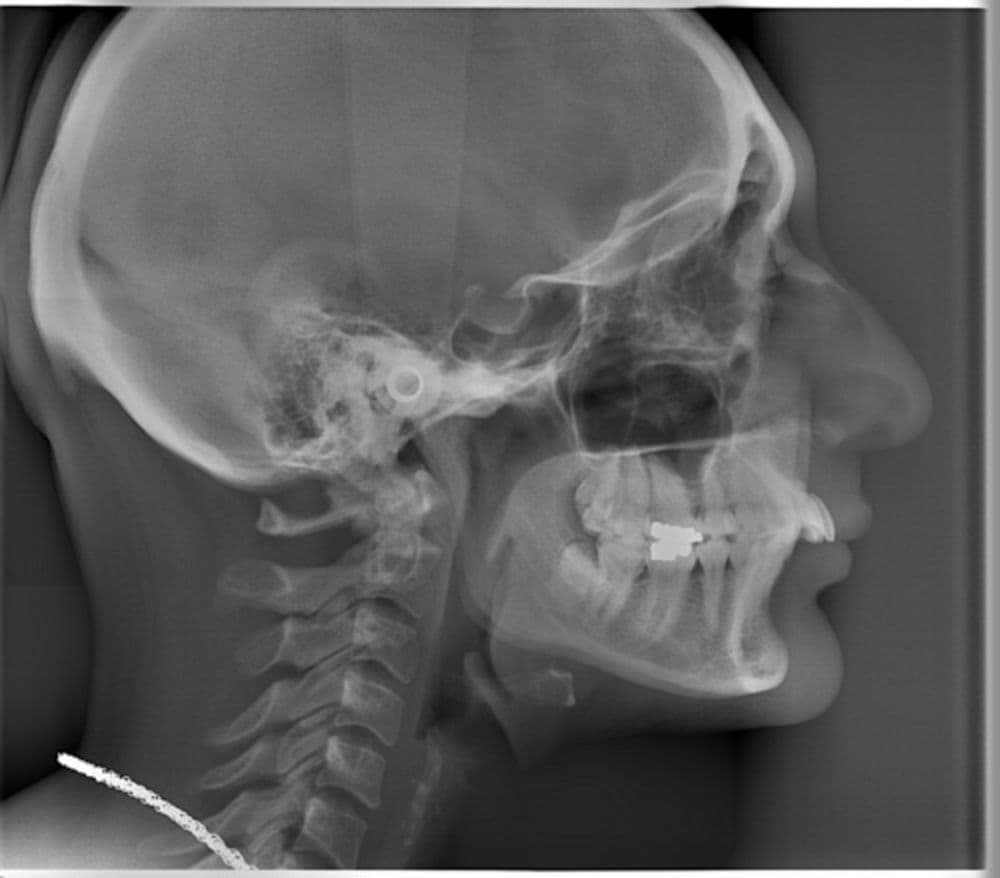 Cephalometric