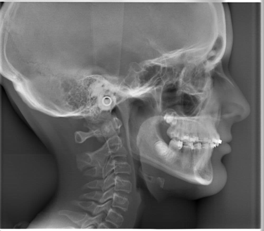Cephalometric 2