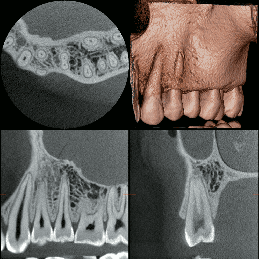 X-ray image