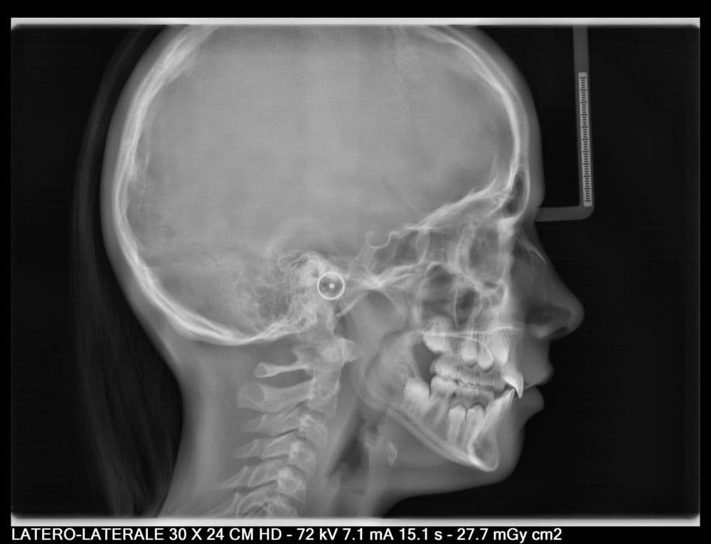 X-Mind Prime with Ceph