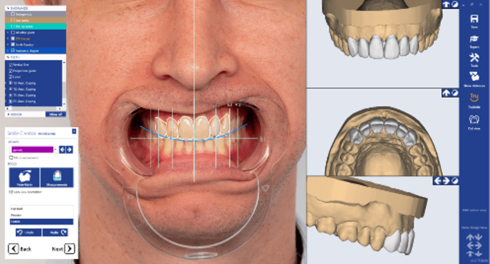 Planmeca PlanCAD Premium Henry Schein Catalog