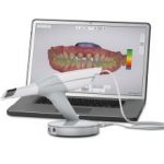 Digital Impressioning Helps Me Be a Better Dentist