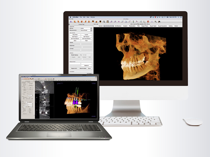 Why I Use KaVo 3D Imaging