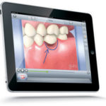 The Impact of New Dental Technology
