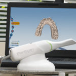 Planmeca FIT Offers Minimally Invasive Crowns in Same-Day Dental Treatment
