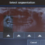Multi-Modality Endodontics with 3D Imaging —What to Look for in a New Imaging Unit