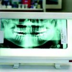 The Diagnostic Efficacy of Digital Imaging in Dentistry