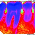 Why Every Dental Office Needs to Install Digital Radiography