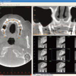 Exploring Cone Beam 3–D Dental Imaging