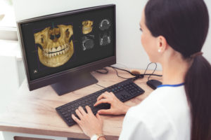 Why 3D Imaging is Changing the Game for Implant Treatment Planning